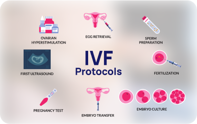 IVF Protocols